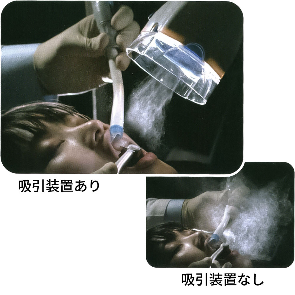 口腔外サクション